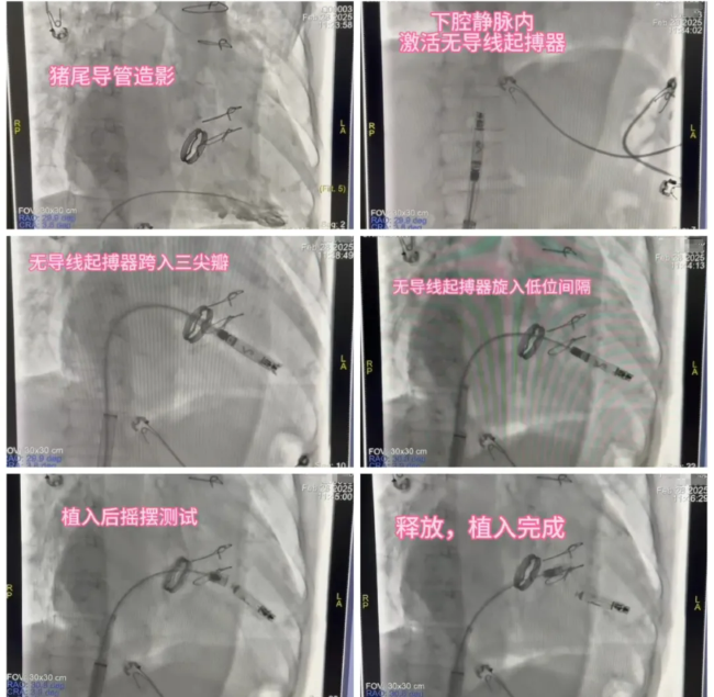 屏幕截图 2025-04-07 084309.png